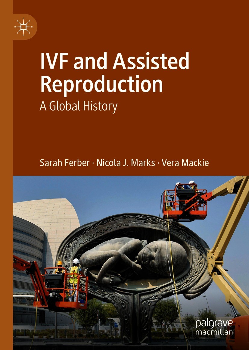 Titlebook: IVF and Assisted Reproduction; A Global History Sarah Ferber,Nicola J. Marks,Vera Mackie Book 2020 The Editor(s) (if applicable) and The Au Titlebook: IVF and Assisted Reproduction; A Global History Sarah Ferber,Nicola J. Marks,Vera Mackie Book 2020 The Editor(s) (if applicable) and The Au