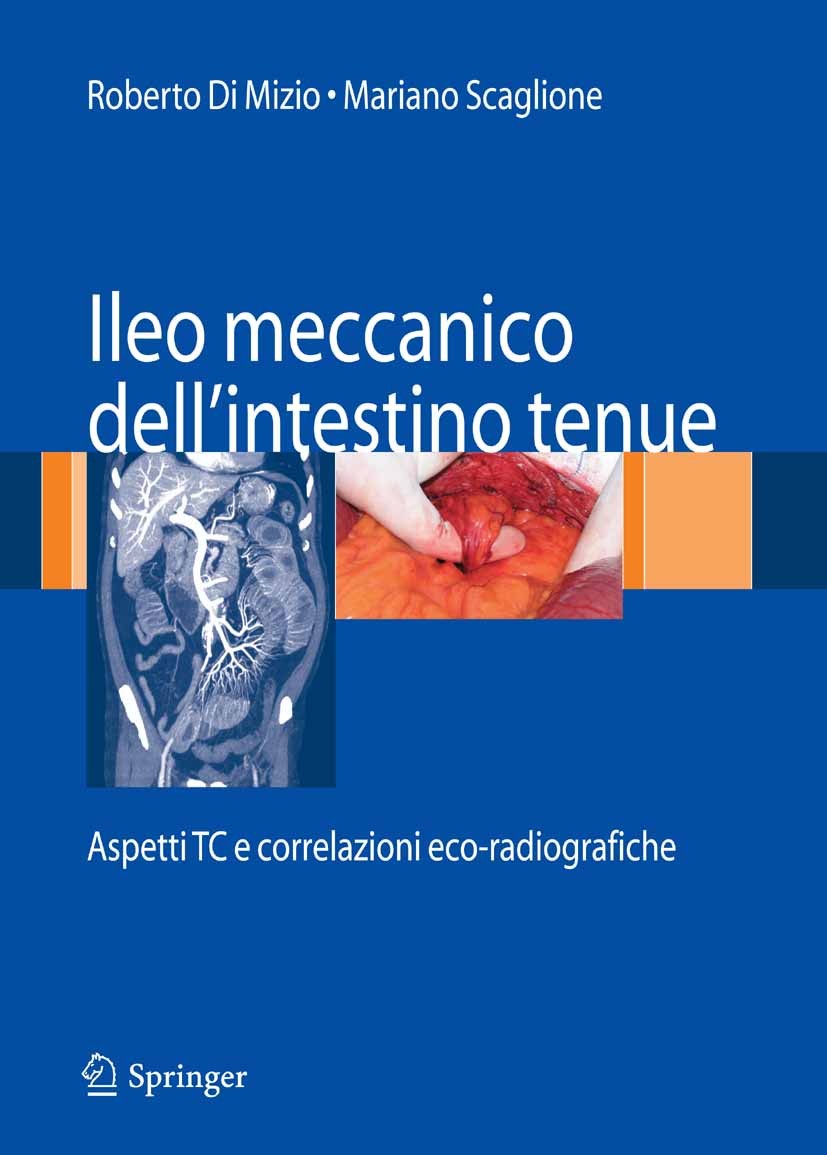 Titlebook: Ileo meccanico dell‘intestino tenue; Aspetti TC e correla Roberto Mizio (Direttore Servizio di Radiologia),M Book 2007 Springer-Verlag Mila Titlebook: Ileo meccanico dell‘intestino tenue; Aspetti TC e correla Roberto Mizio (Direttore Servizio di Radiologia),M Book 2007 Springer-Verlag Mila
