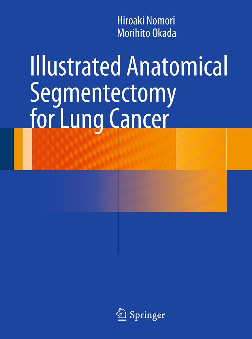 Titlebook: Illustrated Anatomical Segmentectomy for Lung Cancer; Hiroaki Nomori,Morihito Okada Book 2012 Springer Japan 2012 Lung Cancer.Segmentectom Titlebook: Illustrated Anatomical Segmentectomy for Lung Cancer; Hiroaki Nomori,Morihito Okada Book 2012 Springer Japan 2012 Lung Cancer.Segmentectom
