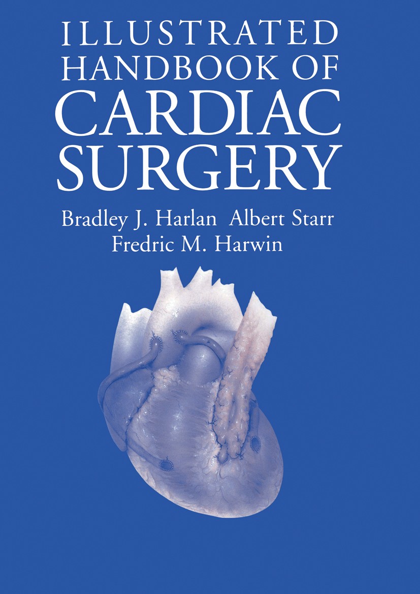 Titlebook: Illustrated Handbook of Cardiac Surgery; Bradley J. Harlan,Albert Starr,Fredric M. Harwin Book 1996 Springer-Verlag New York Inc. 1996 Byp Titlebook: Illustrated Handbook of Cardiac Surgery; Bradley J. Harlan,Albert Starr,Fredric M. Harwin Book 1996 Springer-Verlag New York Inc. 1996 Byp