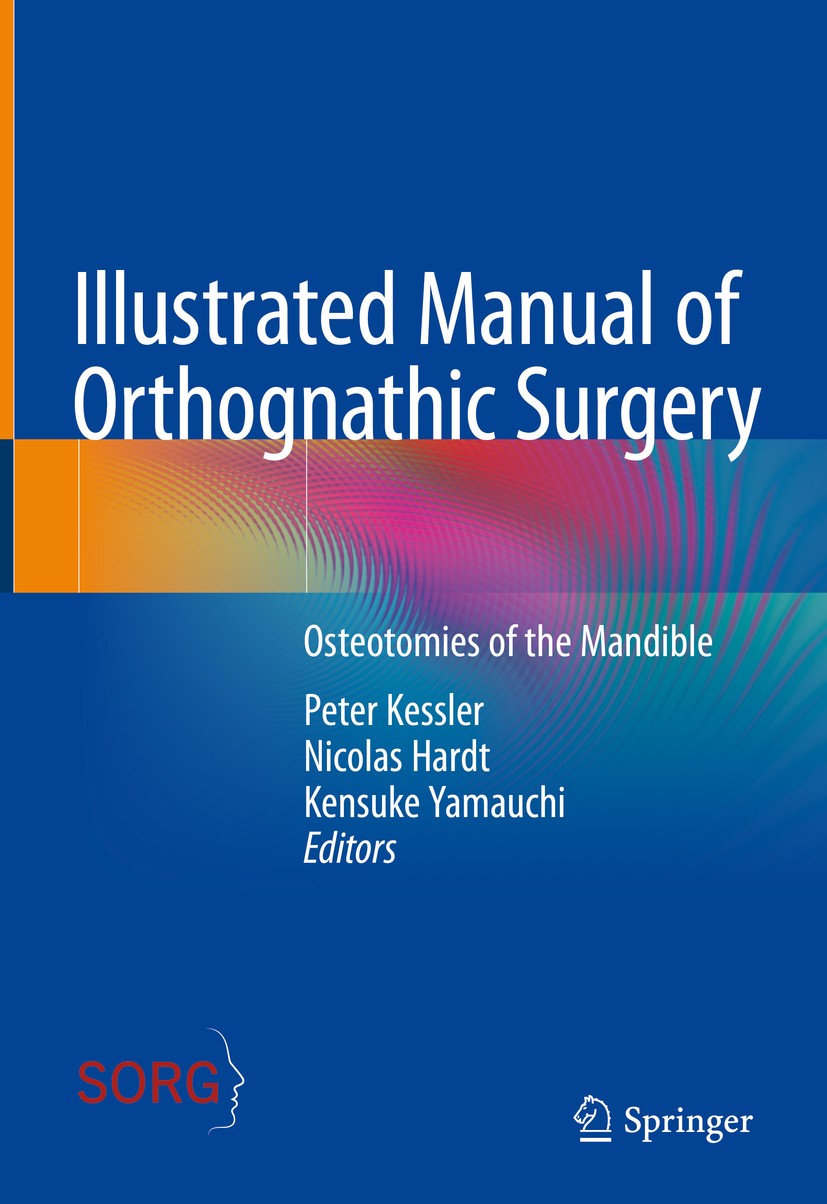 Titlebook: Illustrated Manual of Orthognathic Surgery; Osteotomies of the M Peter Kessler,Nicolas Hardt,Kensuke Yamauchi Book 2024 The Editor(s) (if a Titlebook: Illustrated Manual of Orthognathic Surgery; Osteotomies of the M Peter Kessler,Nicolas Hardt,Kensuke Yamauchi Book 2024 The Editor(s) (if a
