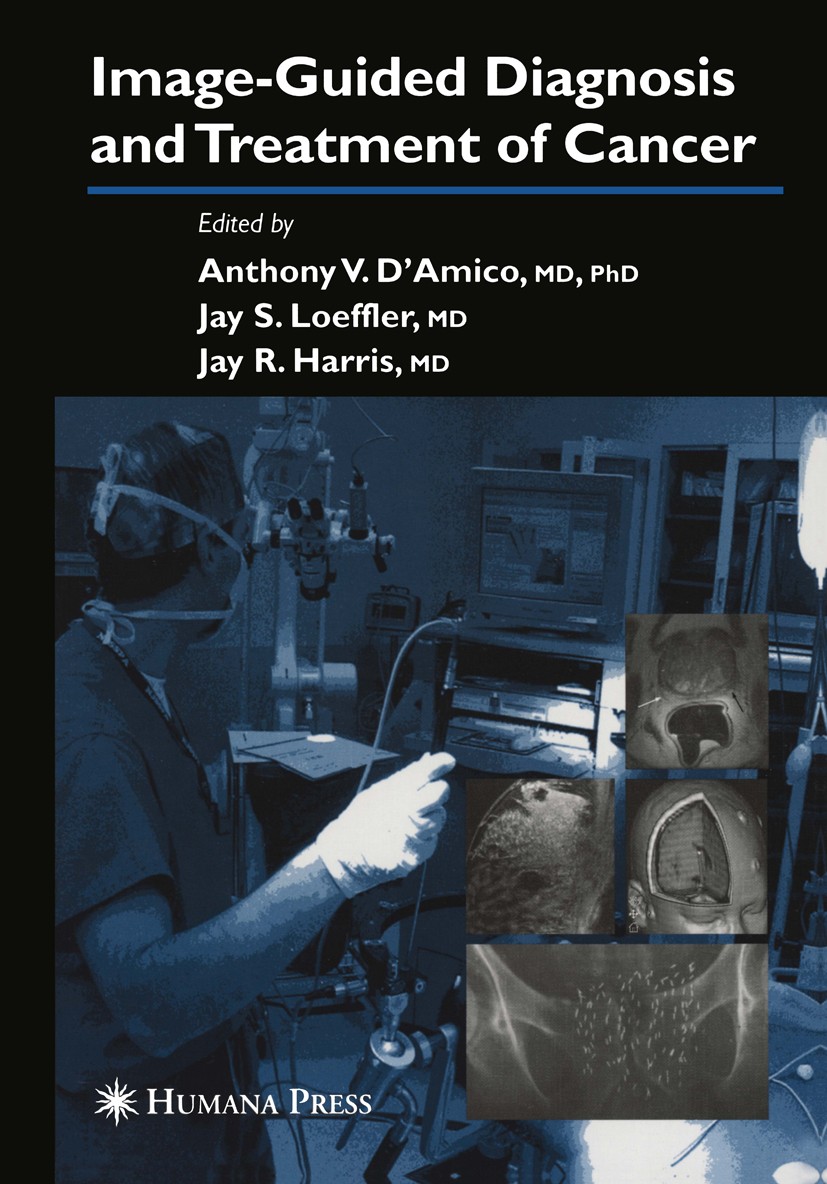 Titlebook: Image-Guided Diagnosis and Treatment of Cancer; Anthony V. D’Amico,Jay S. Loeffler,Jay R. Harris Book 2003 Springer Science+Business Media Titlebook: Image-Guided Diagnosis and Treatment of Cancer; Anthony V. D’Amico,Jay S. Loeffler,Jay R. Harris Book 2003 Springer Science+Business Media