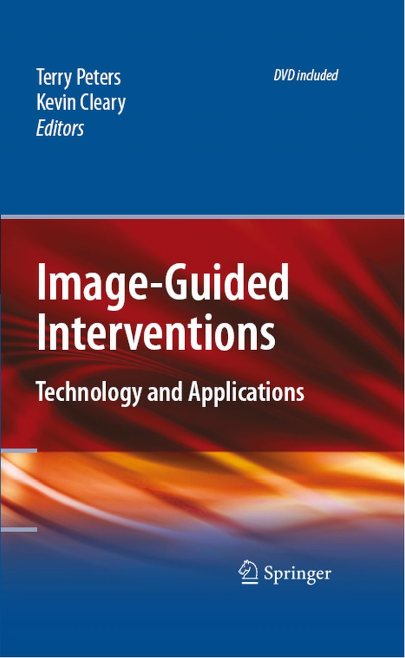 Titlebook: Image-Guided Interventions; Technology and Appli Terry Peters,Kevin Cleary Book 2008 Springer-Verlag US 2008 augmented reality.computer.def Titlebook: Image-Guided Interventions; Technology and Appli Terry Peters,Kevin Cleary Book 2008 Springer-Verlag US 2008 augmented reality.computer.def