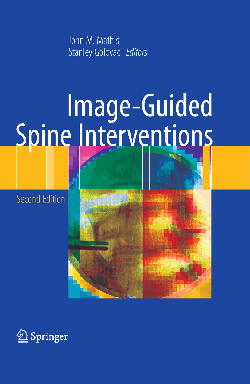 Titlebook: Image-Guided Spine Interventions; John M. Mathis,Stanley Golovac Book 2010Latest edition Springer-Verlag New York 2010 Image-Guided.Imagin Titlebook: Image-Guided Spine Interventions; John M. Mathis,Stanley Golovac Book 2010Latest edition Springer-Verlag New York 2010 Image-Guided.Imagin