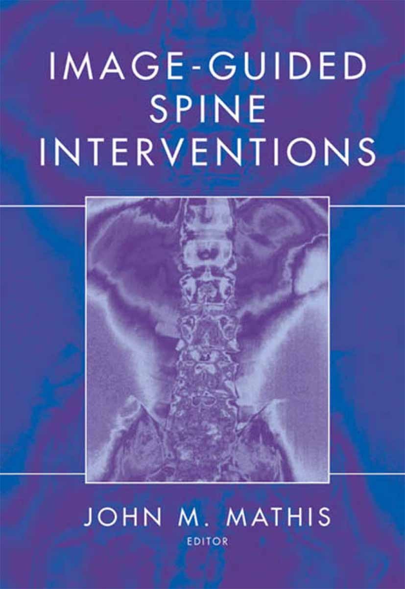 Titlebook: Image-Guided Spine Interventions; Blake A. Johnson,Peter S. Staats,John M. Mathis (C Book 20041st edition Springer Science+Business Media Titlebook: Image-Guided Spine Interventions; Blake A. Johnson,Peter S. Staats,John M. Mathis (C Book 20041st edition Springer Science+Business Media