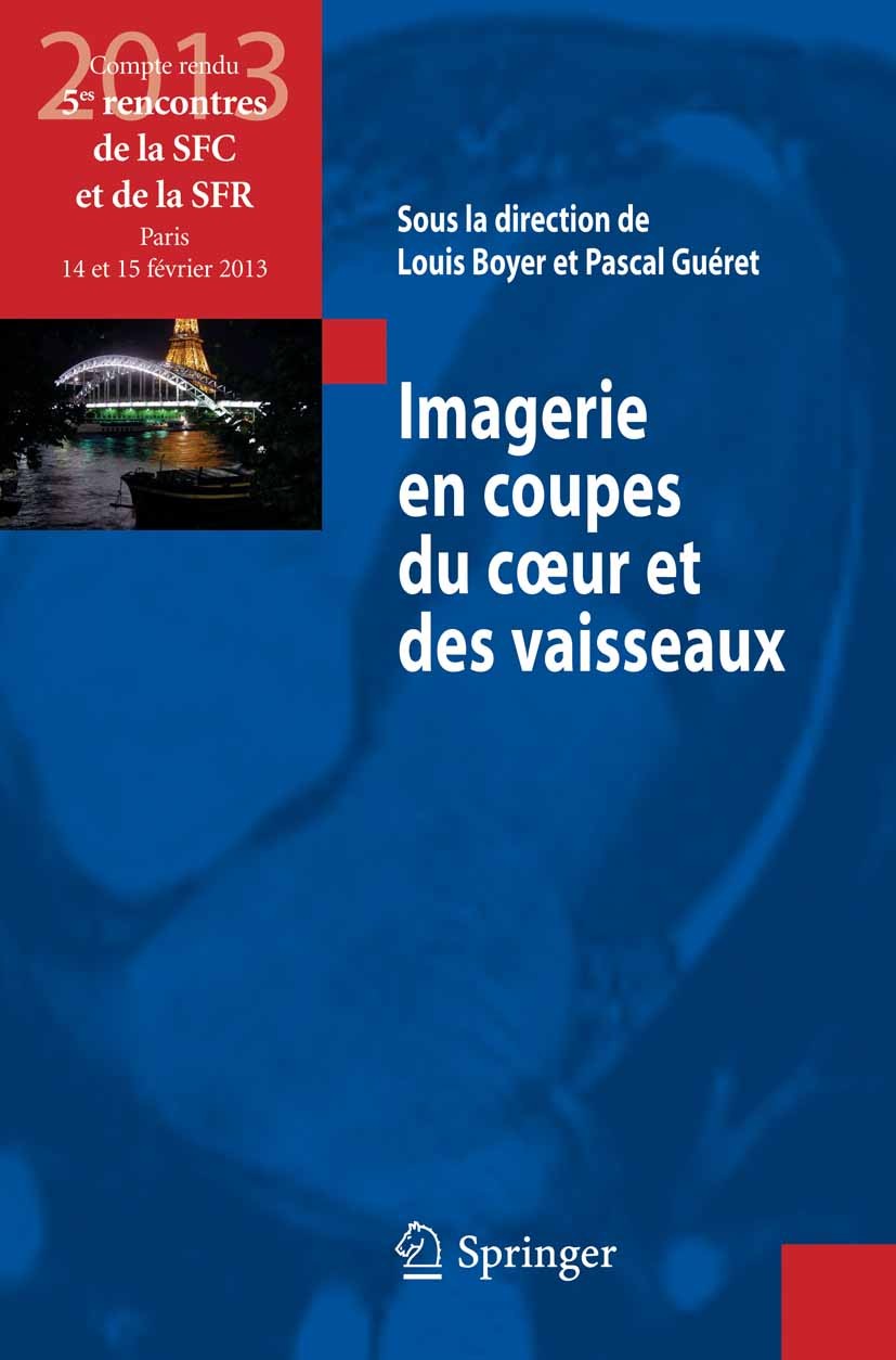 Titlebook: Imagerie en coupes du coeur et des vaisseaux; Compte rendu des 5es Louis Boyer,Pascal Guéret Conference proceedings 2013Latest edition Spri Titlebook: Imagerie en coupes du coeur et des vaisseaux; Compte rendu des 5es Louis Boyer,Pascal Guéret Conference proceedings 2013Latest edition Spri