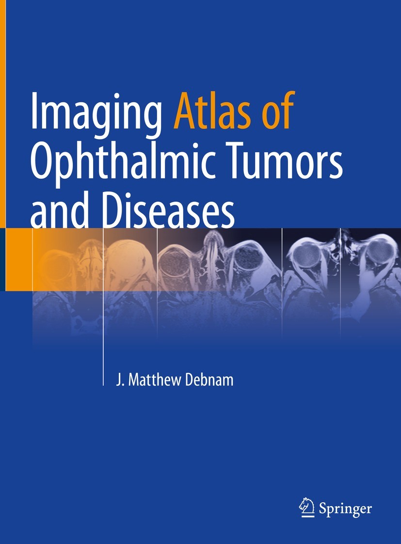 Titlebook: Imaging Atlas of Ophthalmic Tumors and Diseases; J. Matthew Debnam Book 2023 The Editor(s) (if applicable) and The Author(s), under exclus Titlebook: Imaging Atlas of Ophthalmic Tumors and Diseases; J. Matthew Debnam Book 2023 The Editor(s) (if applicable) and The Author(s), under exclus