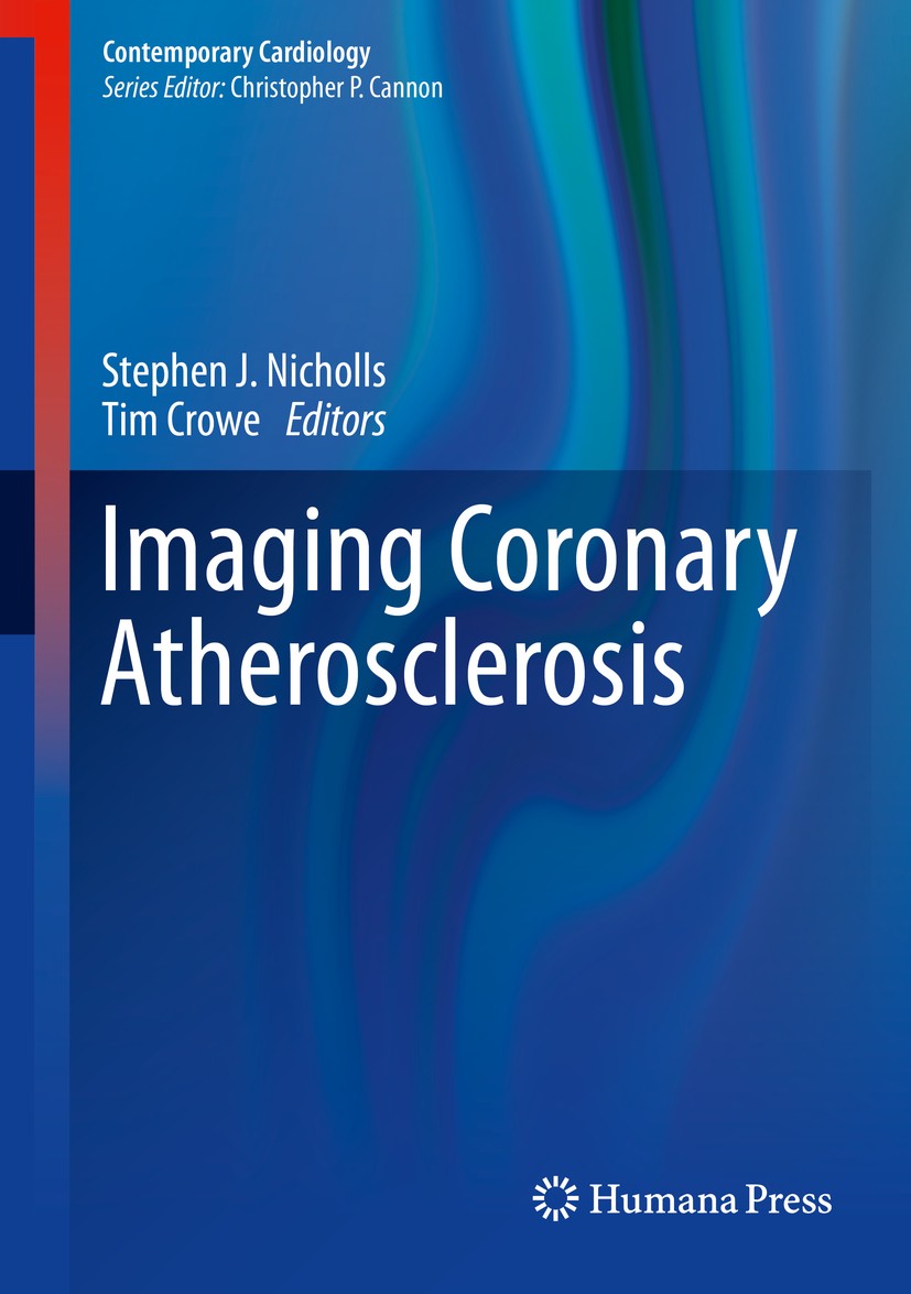 Titlebook: Imaging Coronary Atherosclerosis; Stephen J. Nicholls,Tim Crowe Book 2014 Springer Science+Business Media New York 2014 Titlebook: Imaging Coronary Atherosclerosis; Stephen J. Nicholls,Tim Crowe Book 2014 Springer Science+Business Media New York 2014