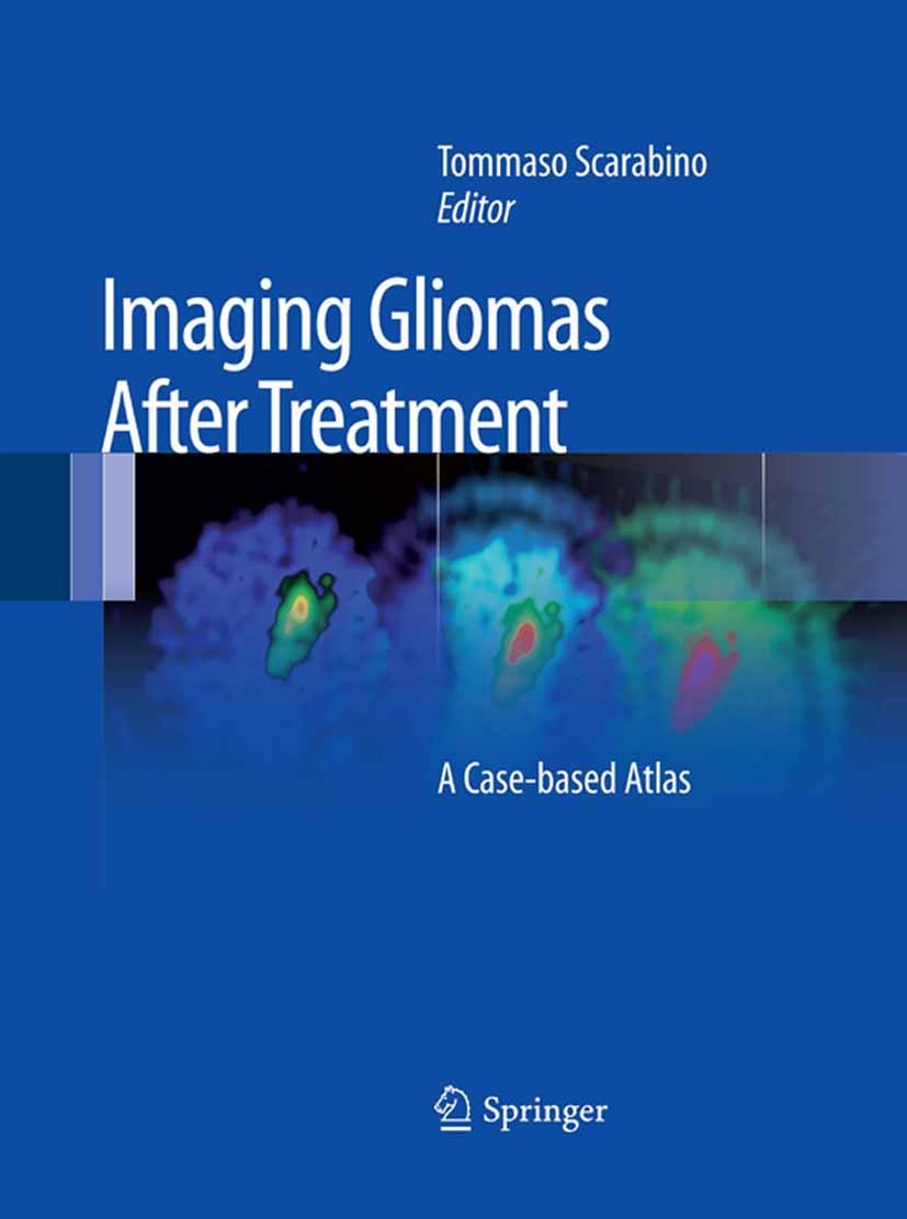 Titlebook: Imaging Gliomas After Treatment; A Case-based Atlas Tommaso Scarabino Book 20121st edition Springer-Verlag Italia 2012 MR diffusion.MR perf Titlebook: Imaging Gliomas After Treatment; A Case-based Atlas Tommaso Scarabino Book 20121st edition Springer-Verlag Italia 2012 MR diffusion.MR perf