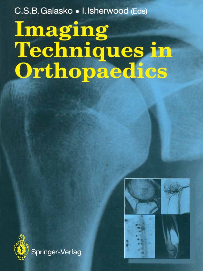Titlebook: Imaging Techniques in Orthopaedics; C. S. B. Galasko (Professor of Orthopaedic Surgery Book 1989 Springer-Verlag Berlin Heidelberg 1989 an Titlebook: Imaging Techniques in Orthopaedics; C. S. B. Galasko (Professor of Orthopaedic Surgery Book 1989 Springer-Verlag Berlin Heidelberg 1989 an