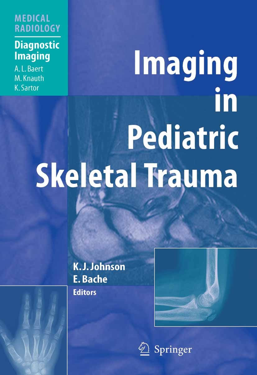 Titlebook: Imaging in Pediatric Skeletal Trauma; Techniques and Appli Karl J. Johnson (Consultant Paediatric Radiologist Book 2008 Springer-Verlag Ber Titlebook: Imaging in Pediatric Skeletal Trauma; Techniques and Appli Karl J. Johnson (Consultant Paediatric Radiologist Book 2008 Springer-Verlag Ber