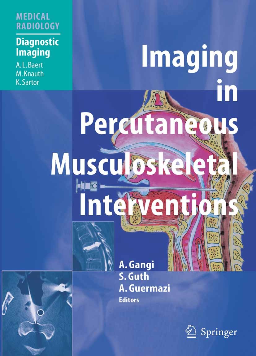 Titlebook: Imaging in Percutaneous Musculoskeletal Interventions; Afshin Gangi (Professor of Radiology),Stéphane Gut Book 2009 Springer-Verlag Berlin Titlebook: Imaging in Percutaneous Musculoskeletal Interventions; Afshin Gangi (Professor of Radiology),Stéphane Gut Book 2009 Springer-Verlag Berlin