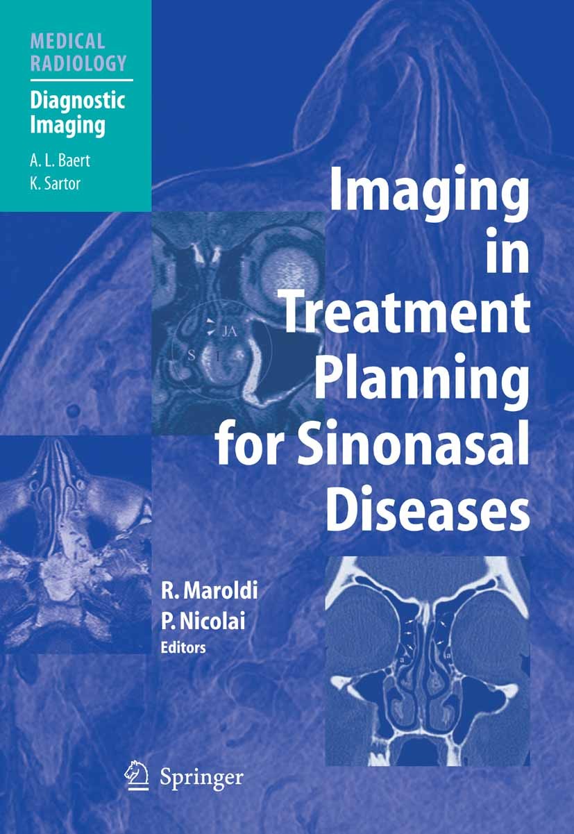 Titlebook: Imaging in Treatment Planning for Sinonasal Diseases; Roberto Maroldi (Professor),Piero Nicolai (Profess Book 2005 Springer-Verlag Berlin Titlebook: Imaging in Treatment Planning for Sinonasal Diseases; Roberto Maroldi (Professor),Piero Nicolai (Profess Book 2005 Springer-Verlag Berlin