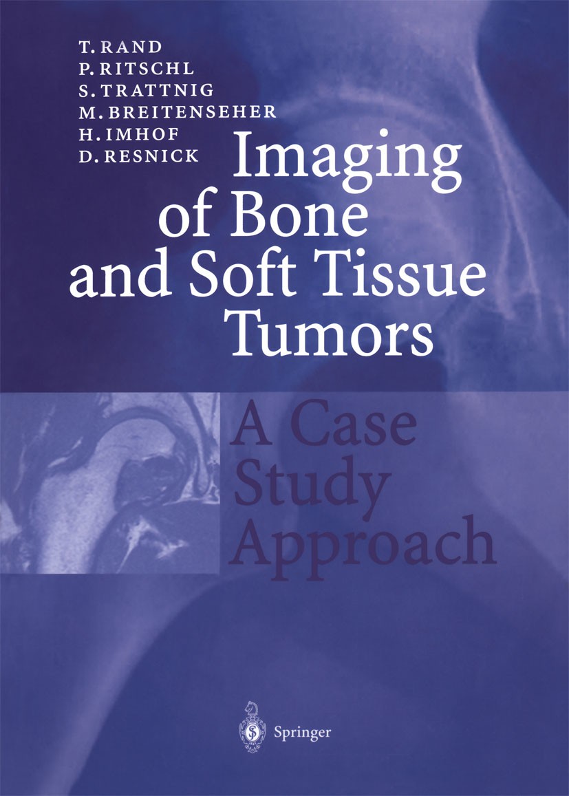 Titlebook: Imaging of Bone and Soft Tissue Tumors; A Case Study Approac Martin Breitenseher,Herwig Imhof,Siegfried Trattni Textbook 2001 Springer-Verl Titlebook: Imaging of Bone and Soft Tissue Tumors; A Case Study Approac Martin Breitenseher,Herwig Imhof,Siegfried Trattni Textbook 2001 Springer-Verl
