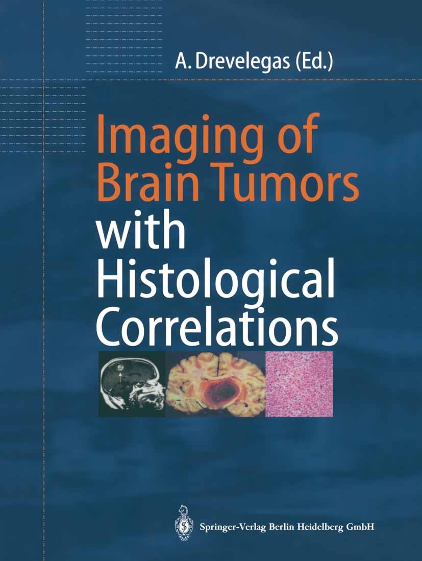 Titlebook: Imaging of Brain Tumors with Histological Correlations; Antonios Drevelegas Book 20021st edition Springer-Verlag Berlin Heidelberg 2002 Tu Titlebook: Imaging of Brain Tumors with Histological Correlations; Antonios Drevelegas Book 20021st edition Springer-Verlag Berlin Heidelberg 2002 Tu