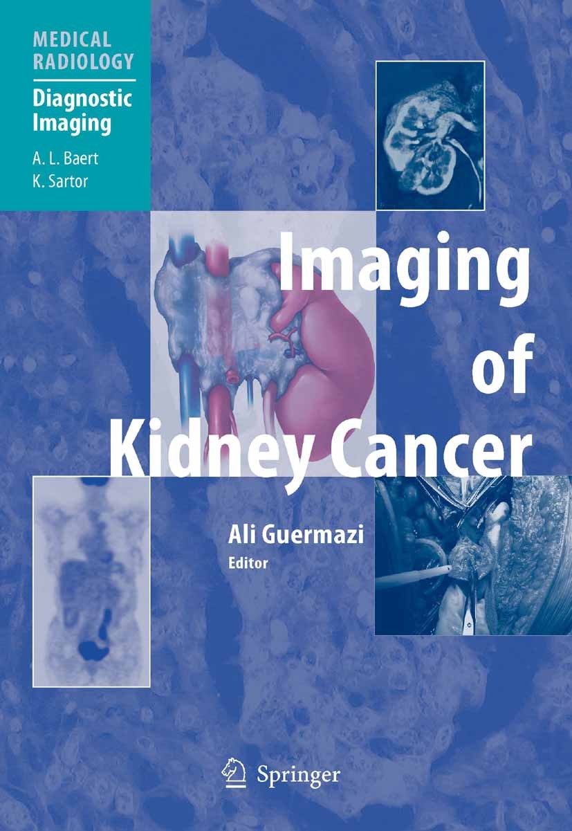 Titlebook: Imaging of Kidney Cancer; Ali Guermazi (Senior Radiologist, Scientific Direc Book 2006 Springer-Verlag Berlin Heidelberg 2006 CT.PET/CT.an Titlebook: Imaging of Kidney Cancer; Ali Guermazi (Senior Radiologist, Scientific Direc Book 2006 Springer-Verlag Berlin Heidelberg 2006 CT.PET/CT.an