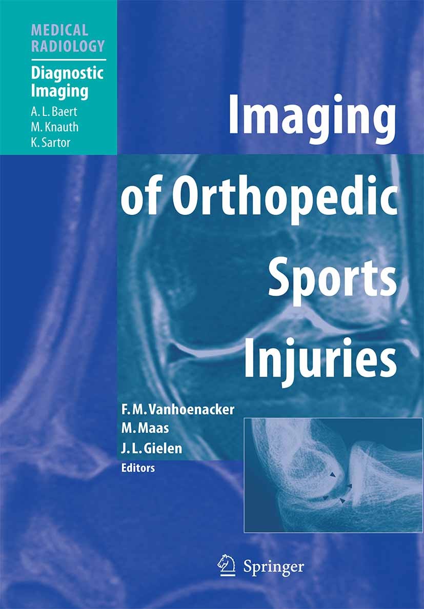 Titlebook: Imaging of Orthopedic Sports Injuries; Filip M. Vanhoenacker,Mario Maas,Jan L. Gielen Book 20071st edition Springer-Verlag Berlin Heidelbe Titlebook: Imaging of Orthopedic Sports Injuries; Filip M. Vanhoenacker,Mario Maas,Jan L. Gielen Book 20071st edition Springer-Verlag Berlin Heidelbe
