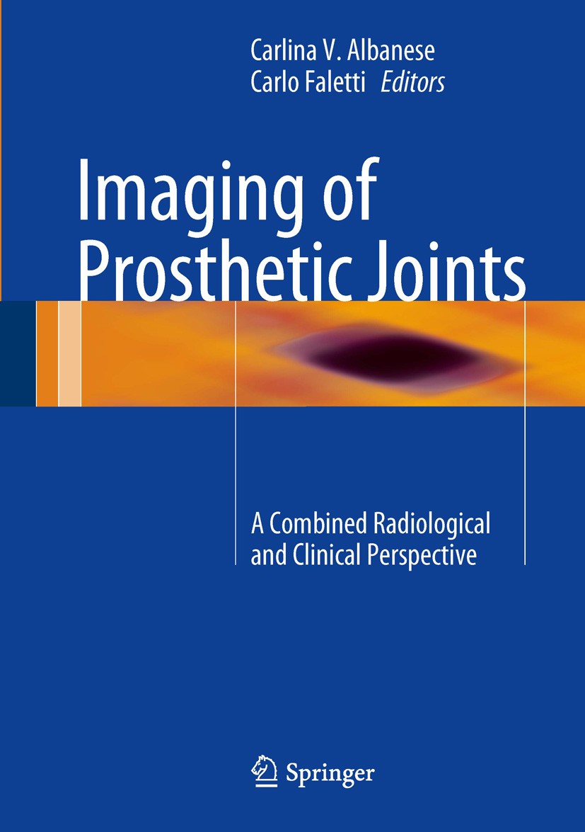 Titlebook: Imaging of Prosthetic Joints; A Combined Radiologi Carlina V. Albanese,Carlo Faletti Book 2014 Springer-Verlag Italia 2014 Implant material Titlebook: Imaging of Prosthetic Joints; A Combined Radiologi Carlina V. Albanese,Carlo Faletti Book 2014 Springer-Verlag Italia 2014 Implant material