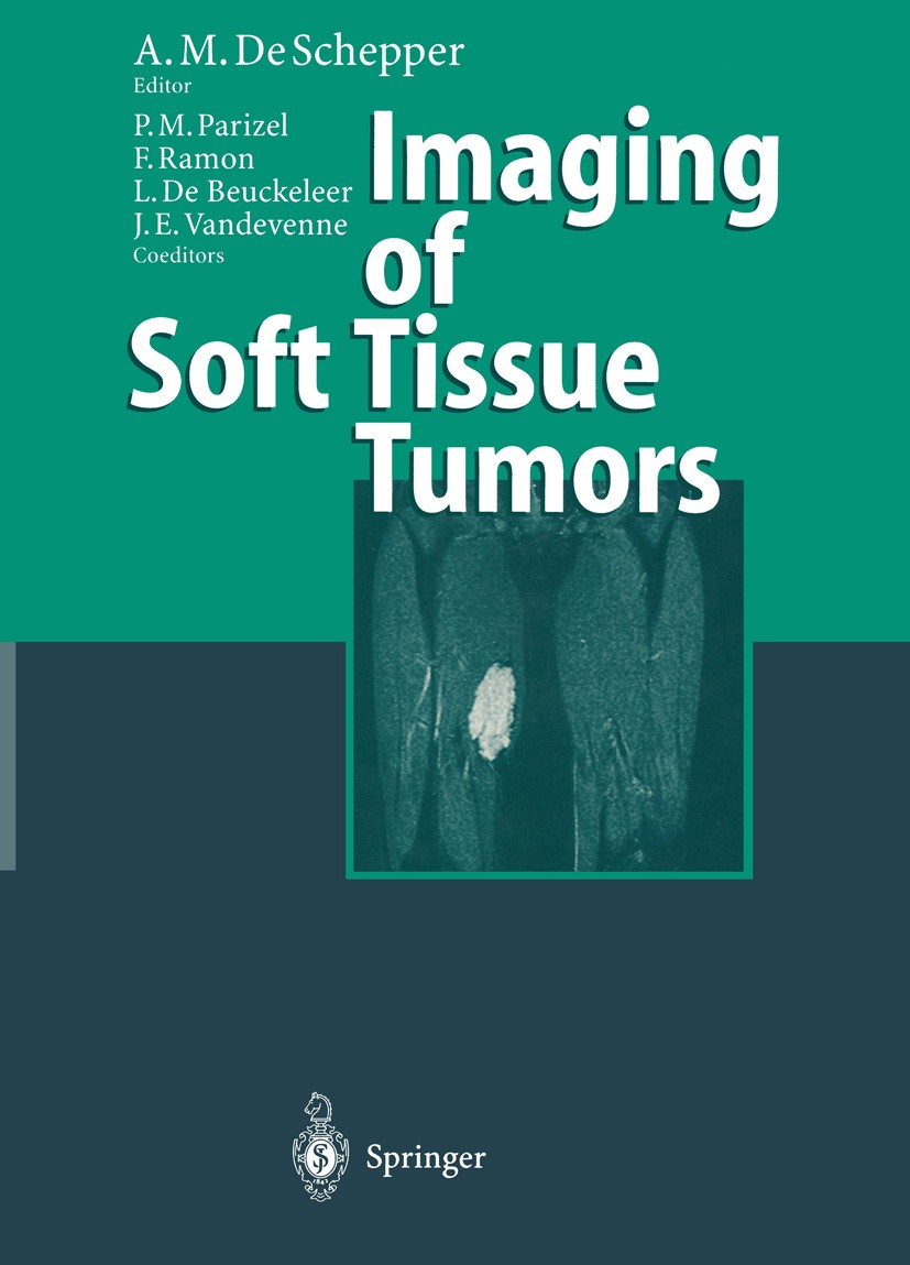 Titlebook: Imaging of Soft Tissue Tumors; Arthur M. Schepper (Professor and Chairman),Paul M Book 19971st edition Springer-Verlag Berlin Heidelberg 1 Titlebook: Imaging of Soft Tissue Tumors; Arthur M. Schepper (Professor and Chairman),Paul M Book 19971st edition Springer-Verlag Berlin Heidelberg 1