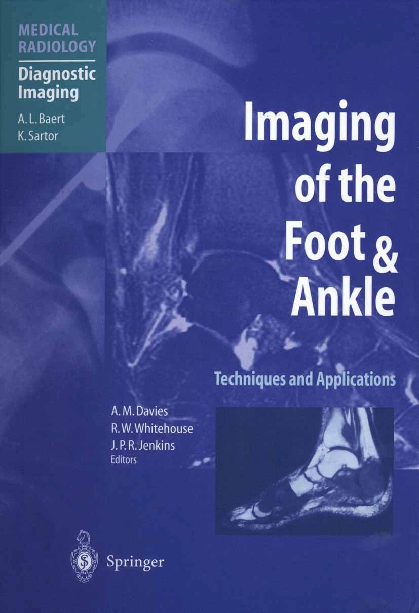 Titlebook: Imaging of the Foot & Ankle; Techniques and Appli A. Mark Davies (Consultant Radiologist),Richard Wi Book 20031st edition Springer-Verlag B Titlebook: Imaging of the Foot & Ankle; Techniques and Appli A. Mark Davies (Consultant Radiologist),Richard Wi Book 20031st edition Springer-Verlag B