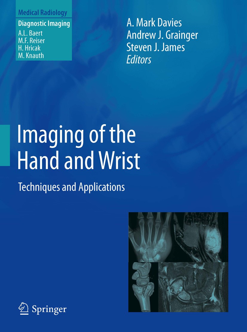 Titlebook: Imaging of the Hand and Wrist; Techniques and Appli A. Mark Davies,Andrew J. Grainger,Steven J. James Book 2013 Springer-Verlag Berlin Heid Titlebook: Imaging of the Hand and Wrist; Techniques and Appli A. Mark Davies,Andrew J. Grainger,Steven J. James Book 2013 Springer-Verlag Berlin Heid