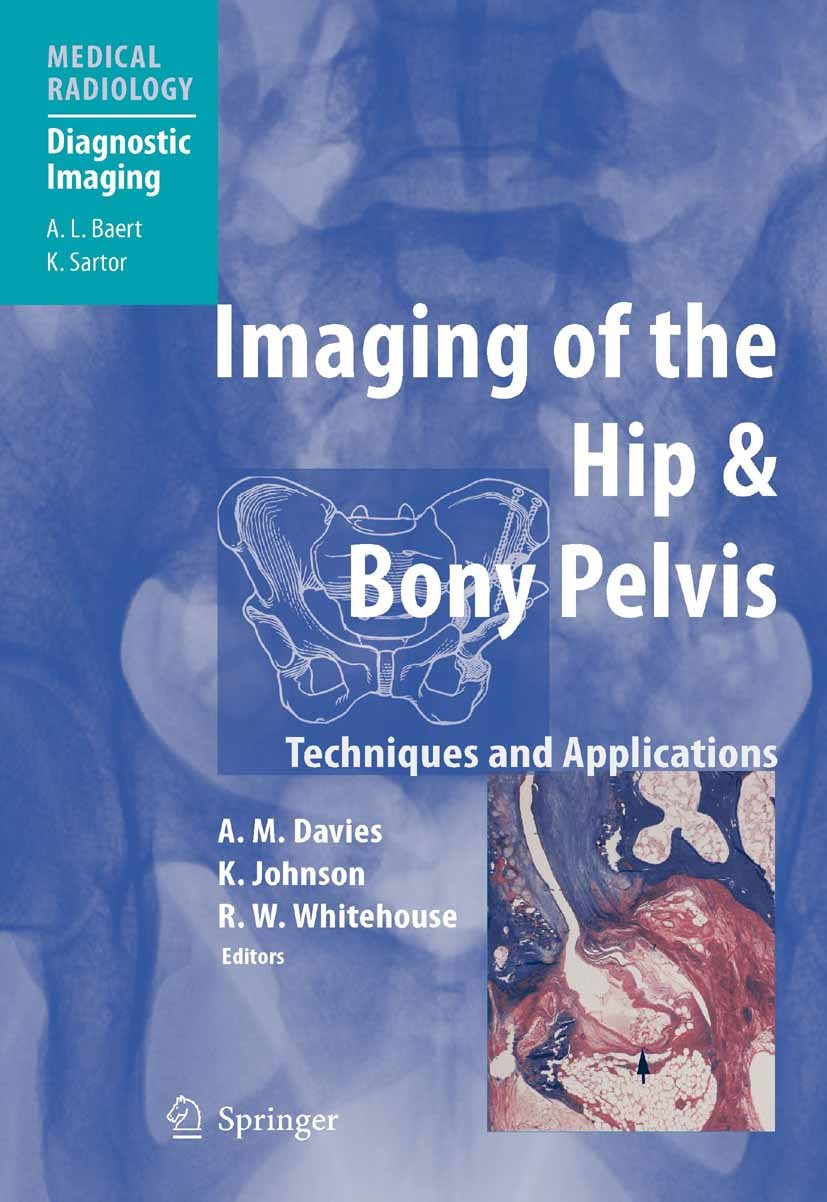 Titlebook: Imaging of the Hip & Bony Pelvis; Techniques and Appli A. Mark Davies (Consultant Radiologist),Karl J. Jo Book 20061st edition Springer-Ver Titlebook: Imaging of the Hip & Bony Pelvis; Techniques and Appli A. Mark Davies (Consultant Radiologist),Karl J. Jo Book 20061st edition Springer-Ver