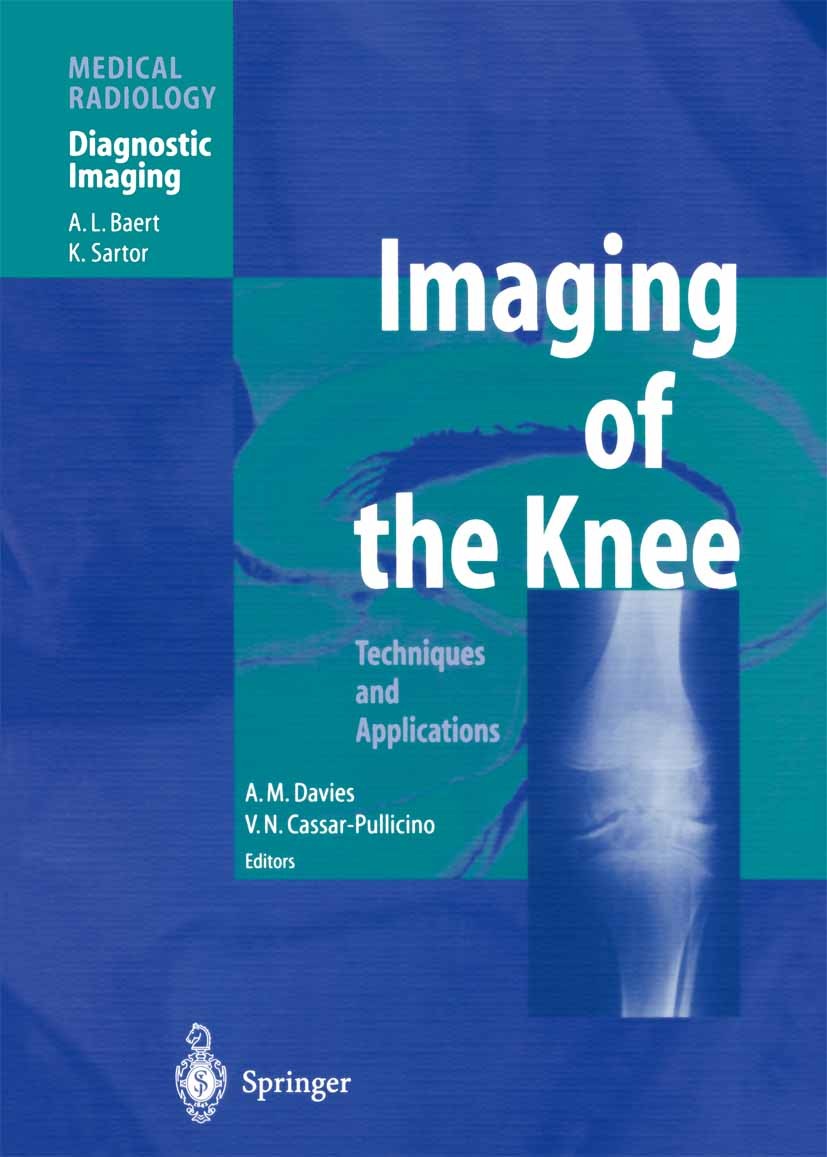 Titlebook: Imaging of the Knee; Techniques and Appli A. M. Davies (Consultant Radiologist),V. Cassar-Pu Book 20031st edition Springer-Verlag Berlin He Titlebook: Imaging of the Knee; Techniques and Appli A. M. Davies (Consultant Radiologist),V. Cassar-Pu Book 20031st edition Springer-Verlag Berlin He