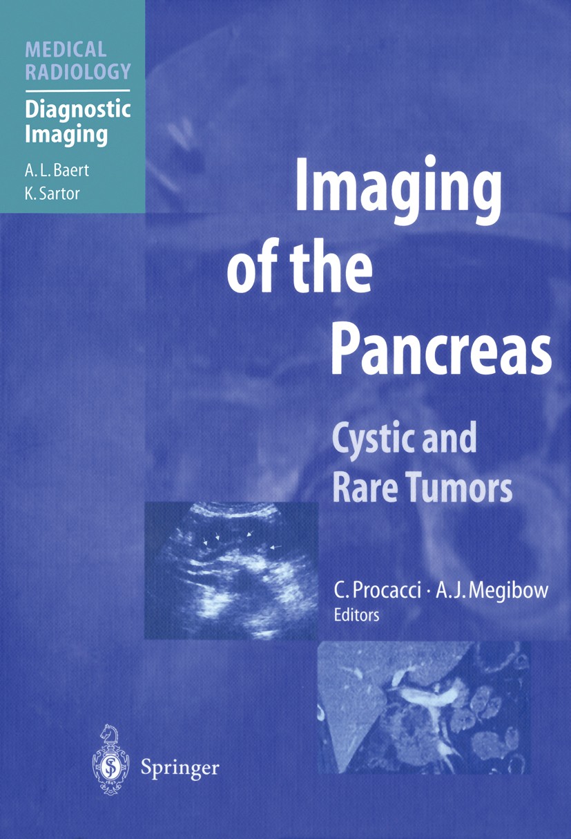 Titlebook: Imaging of the Pancreas; Cystic and Rare Tumo Carlo Procacci (Professor),Alec J. Megibow (Profes Book 2003 Springer-Verlag Berlin Heidelber Titlebook: Imaging of the Pancreas; Cystic and Rare Tumo Carlo Procacci (Professor),Alec J. Megibow (Profes Book 2003 Springer-Verlag Berlin Heidelber