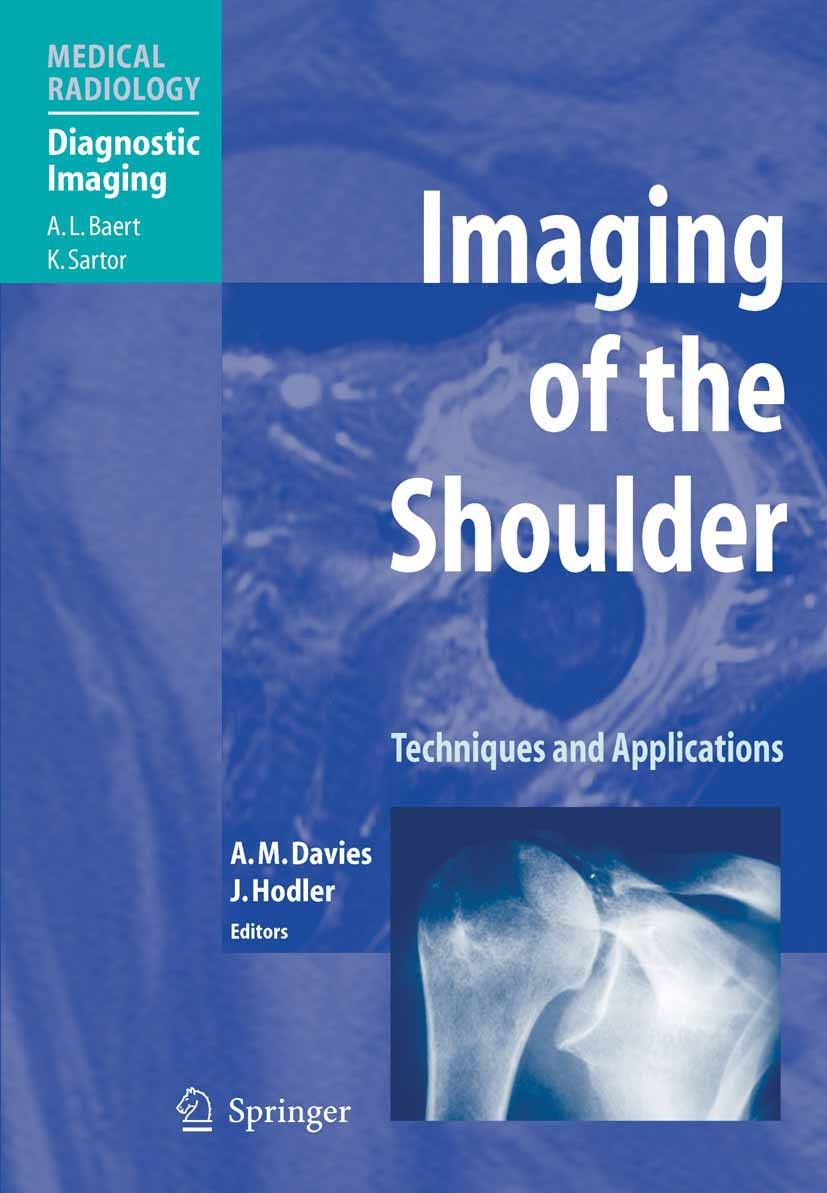 Titlebook: Imaging of the Shoulder; Techniques and Appli A. Mark Davies,Jürg Hodler Book 2004 Springer-Verlag Berlin Heidelberg 2004 Arthritis.Arthrog Titlebook: Imaging of the Shoulder; Techniques and Appli A. Mark Davies,Jürg Hodler Book 2004 Springer-Verlag Berlin Heidelberg 2004 Arthritis.Arthrog