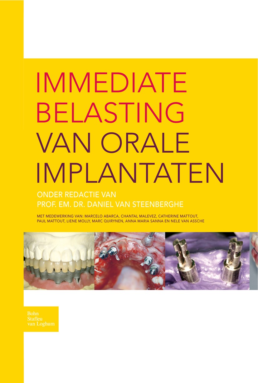Titlebook: Immediate belasting van orale implantaten; Daniel Steenberghe Book 2008Latest edition Bohn Stafleu van Loghum 2008 Titlebook: Immediate belasting van orale implantaten; Daniel Steenberghe Book 2008Latest edition Bohn Stafleu van Loghum 2008