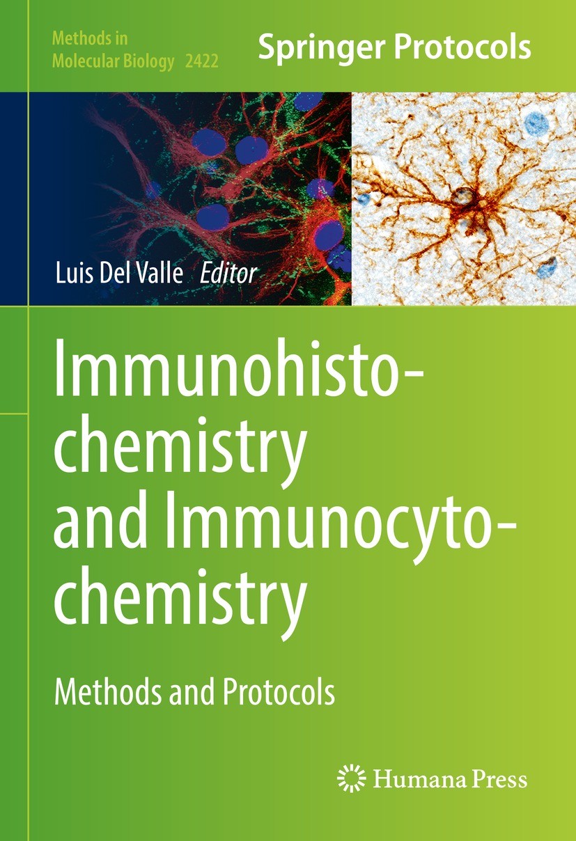 Titlebook: Immunohistochemistry and Immunocytochemistry; Methods and Protocol Luis Del Valle Book 2022 Springer Science+Business Media, LLC, part of S Titlebook: Immunohistochemistry and Immunocytochemistry; Methods and Protocol Luis Del Valle Book 2022 Springer Science+Business Media, LLC, part of S