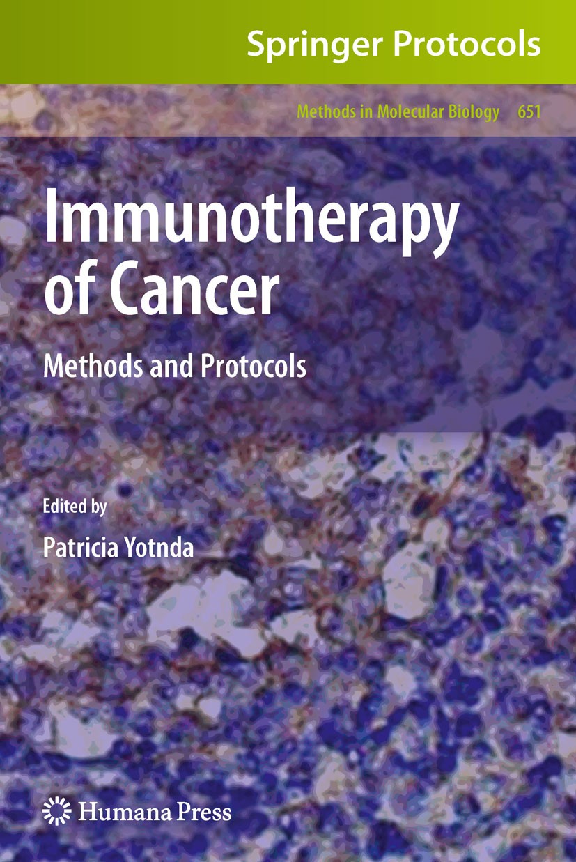 Titlebook: Immunotherapy of Cancer; Methods and Protocol Patricia Yotnda Book 2010 Springer Science+Business Media, LLC 2010 Adoptive immunotherapy.An Titlebook: Immunotherapy of Cancer; Methods and Protocol Patricia Yotnda Book 2010 Springer Science+Business Media, LLC 2010 Adoptive immunotherapy.An