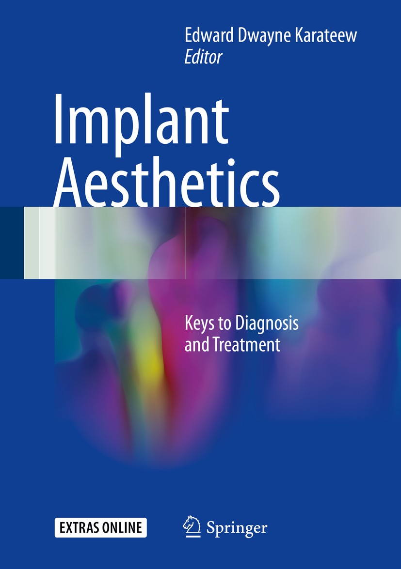 Titlebook: Implant Aesthetics; Keys to Diagnosis an Edward Dwayne Karateew Book 2017 Springer International Publishing AG 2017 Alveolar Bone.Anterior Titlebook: Implant Aesthetics; Keys to Diagnosis an Edward Dwayne Karateew Book 2017 Springer International Publishing AG 2017 Alveolar Bone.Anterior