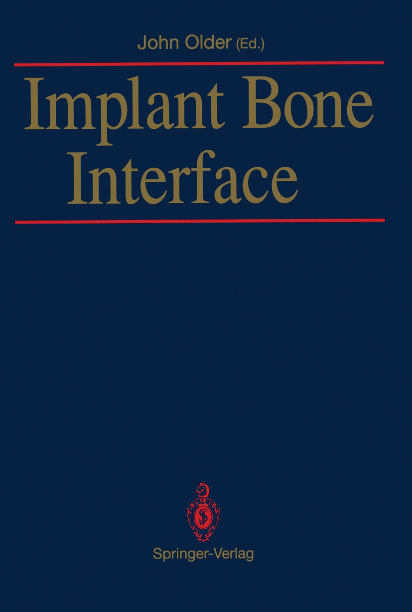 Titlebook: Implant Bone Interface; John Older (Consultant in Orthopaedic and Traumati Book 1990 Springer-Verlag London Limited 1990 Biomechanik.Biome Titlebook: Implant Bone Interface; John Older (Consultant in Orthopaedic and Traumati Book 1990 Springer-Verlag London Limited 1990 Biomechanik.Biome