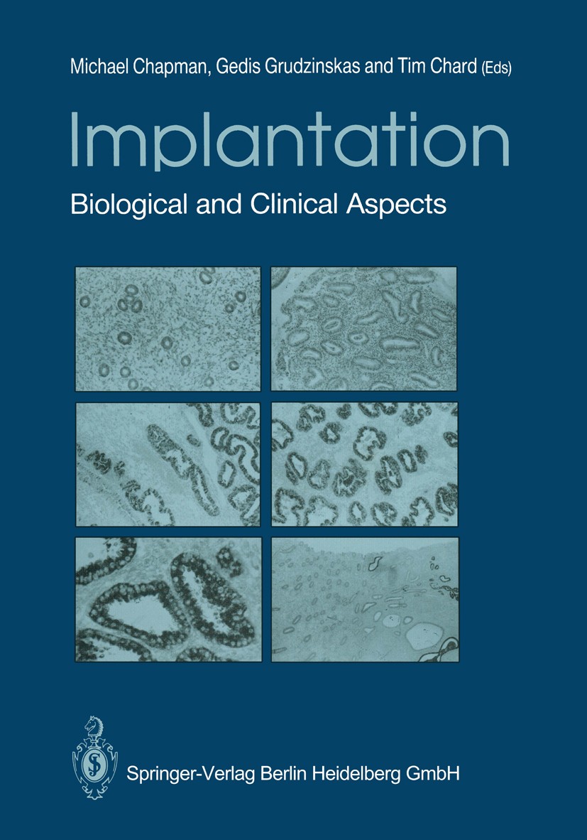 Titlebook: Implantation; Biological and Clini Michael G. Chapman,J. Gedis Grudzinskas,Tim Chard Book 1988 Springer-Verlag Berlin Heidelberg 1988 bioch Titlebook: Implantation; Biological and Clini Michael G. Chapman,J. Gedis Grudzinskas,Tim Chard Book 1988 Springer-Verlag Berlin Heidelberg 1988 bioch