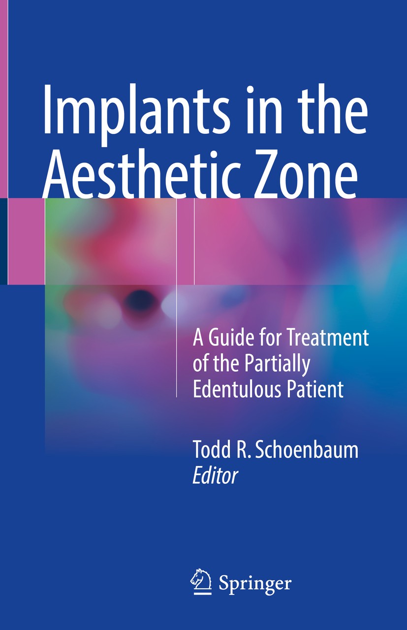 Titlebook: Implants in the Aesthetic Zone; A Guide for Treatmen Todd R. Schoenbaum Book 2019 Springer International Publishing AG, part of Springer Na Titlebook: Implants in the Aesthetic Zone; A Guide for Treatmen Todd R. Schoenbaum Book 2019 Springer International Publishing AG, part of Springer Na