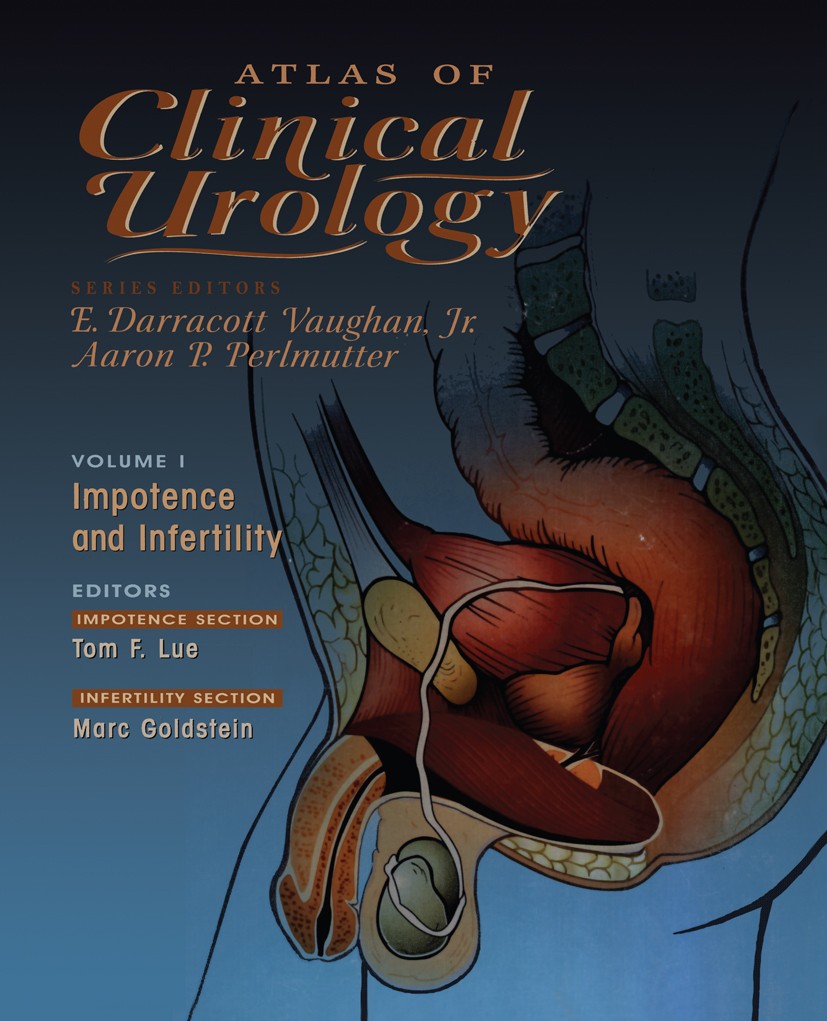 Titlebook: Impotence and Infertility; Tom F. Lue (Professor, Chief of Urology),Marc Gold Book 1999 Springer Science+Business Media New York 1999 erec Titlebook: Impotence and Infertility; Tom F. Lue (Professor, Chief of Urology),Marc Gold Book 1999 Springer Science+Business Media New York 1999 erec