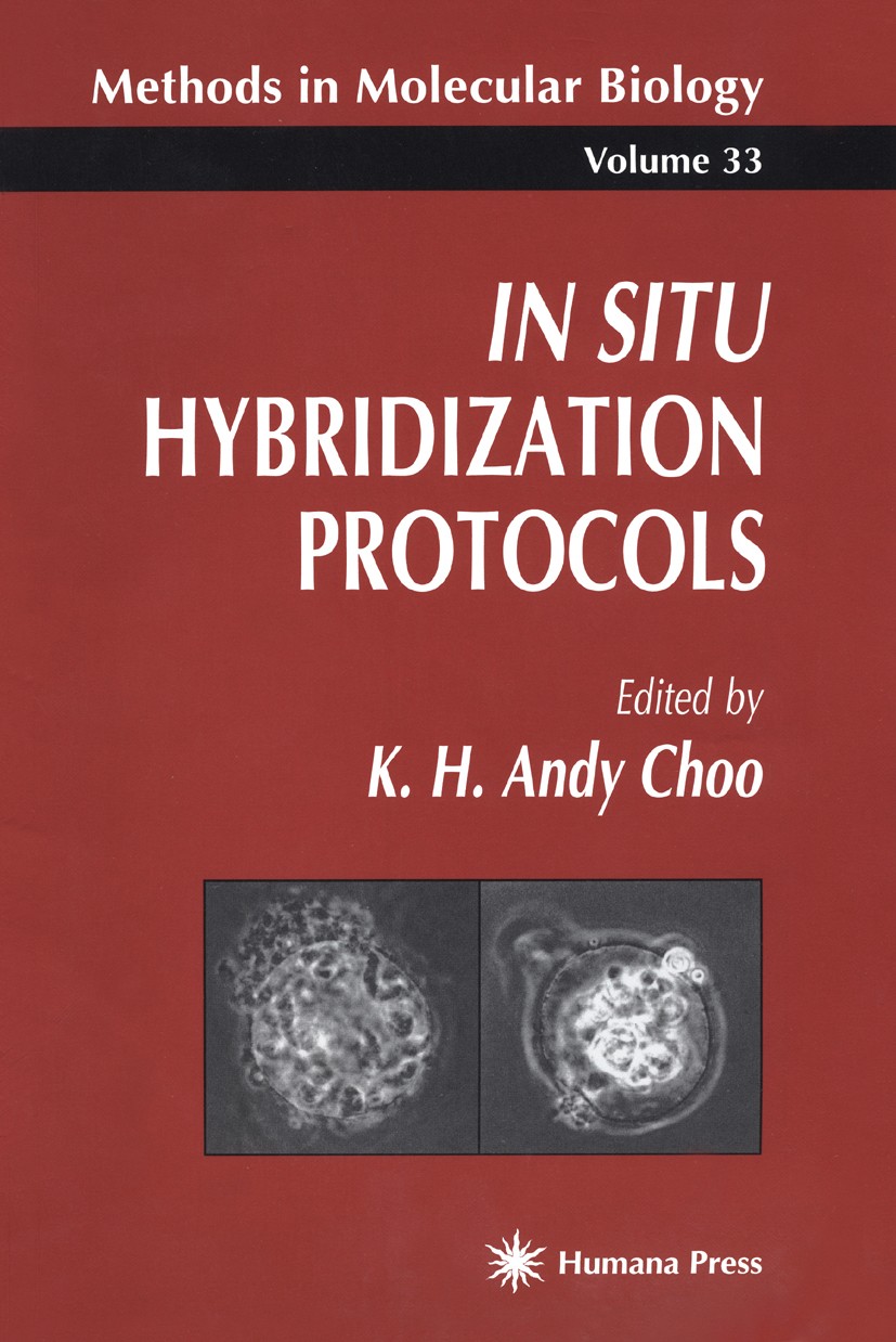 Titlebook: In Situ Hybridization Protocols; K. H. Andy Choo Book Oct 19941st edition Humana Press 1995 Titlebook: In Situ Hybridization Protocols; K. H. Andy Choo Book Oct 19941st edition Humana Press 1995