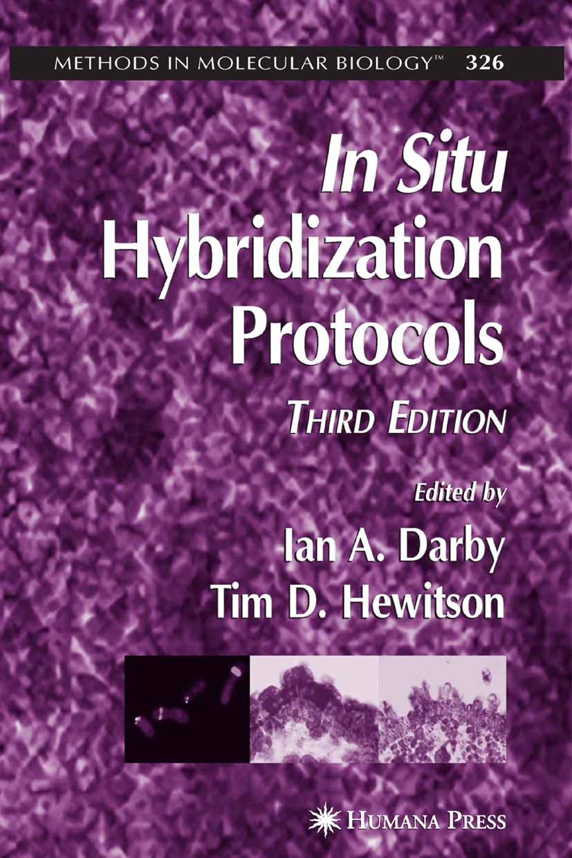 Titlebook: In Situ Hybridization Protocols; Ian A. Darby,Tim D. Hewitson Book 2006Latest edition Humana Press 2006 DNA.Microarray.Termination.electro Titlebook: In Situ Hybridization Protocols; Ian A. Darby,Tim D. Hewitson Book 2006Latest edition Humana Press 2006 DNA.Microarray.Termination.electro