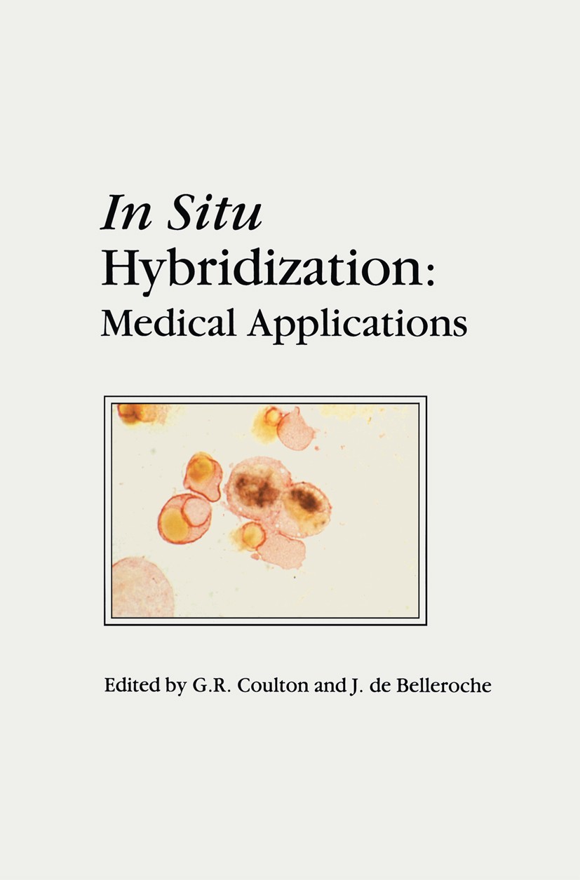 Titlebook: In Situ Hybridization: Medical Applications; G. R. Coulton,J. Belleroche Book 1992 Springer Science+Business Media Dordrecht 1992 Chromoso Titlebook: In Situ Hybridization: Medical Applications; G. R. Coulton,J. Belleroche Book 1992 Springer Science+Business Media Dordrecht 1992 Chromoso