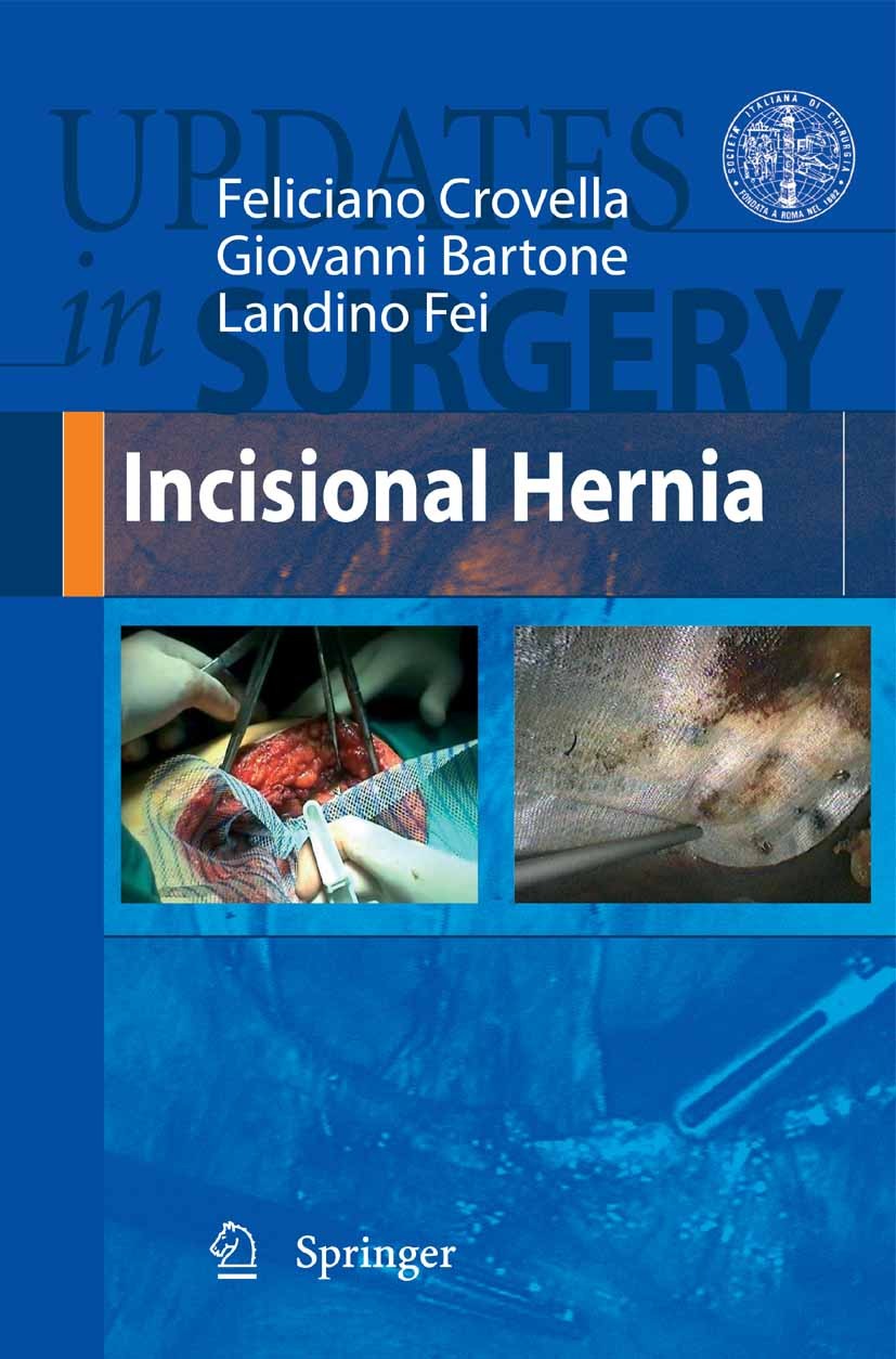 Titlebook: Incisional Hernia; Feliciano Crovella,Giovanni Bartone,Landino Fei Book 2008 Springer-Verlag Milan 2008 Incisional hernia.Surgery.abdomina Titlebook: Incisional Hernia; Feliciano Crovella,Giovanni Bartone,Landino Fei Book 2008 Springer-Verlag Milan 2008 Incisional hernia.Surgery.abdomina