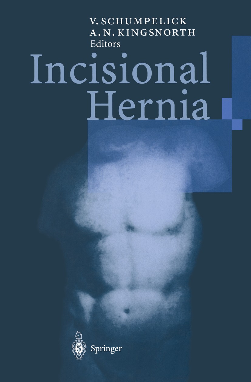 Titlebook: Incisional Hernia; Volker Schumpelick,Andrew N. Kingsnorth Conference proceedings 1999 Springer-Verlag Berlin Heidelberg 1999 abdominal wa Titlebook: Incisional Hernia; Volker Schumpelick,Andrew N. Kingsnorth Conference proceedings 1999 Springer-Verlag Berlin Heidelberg 1999 abdominal wa