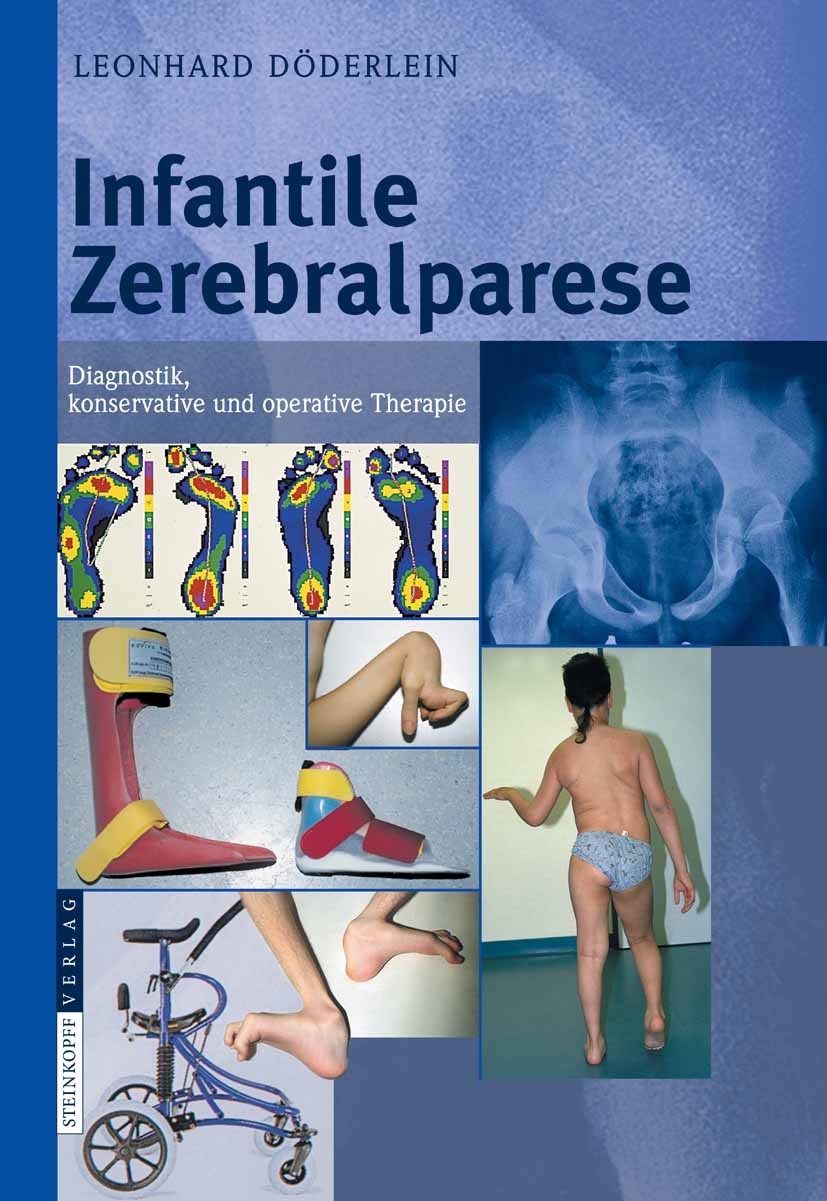 Titlebook: Infantile Zerebralparese; Diagnostik, konserva Leonhard Döderlein Book 20071st edition Steinkopff-Verlag Darmstadt 2007 Bewegung.Bewegungsa Titlebook: Infantile Zerebralparese; Diagnostik, konserva Leonhard Döderlein Book 20071st edition Steinkopff-Verlag Darmstadt 2007 Bewegung.Bewegungsa