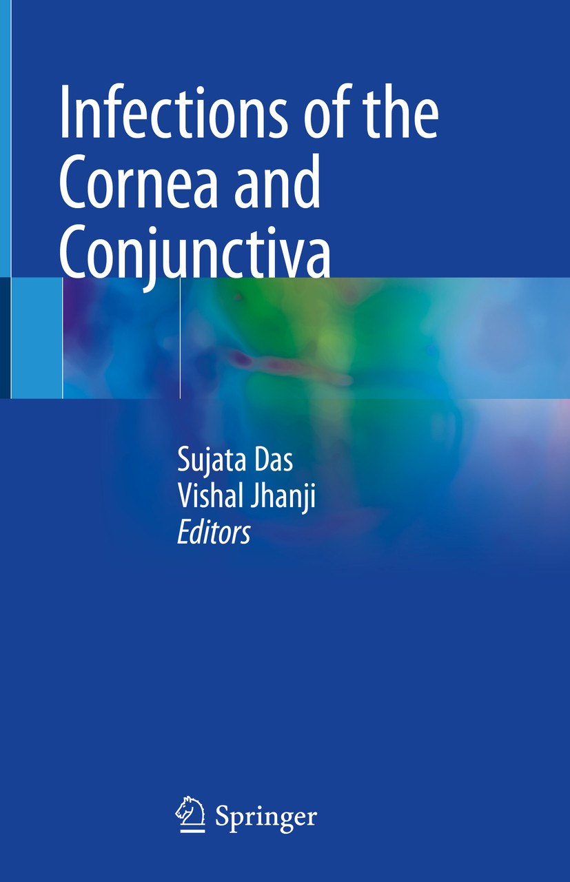 Titlebook: Infections of the Cornea and Conjunctiva; Sujata Das,Vishal Jhanji Book 2021 Springer Nature Singapore Pte Ltd. 2021 Viral Conjunctivitis. Titlebook: Infections of the Cornea and Conjunctiva; Sujata Das,Vishal Jhanji Book 2021 Springer Nature Singapore Pte Ltd. 2021 Viral Conjunctivitis.