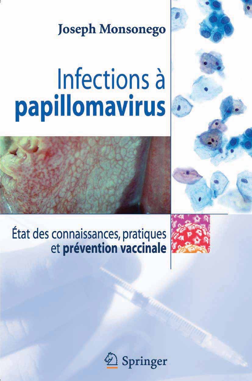 Titlebook: Infections à papillomavirus; État des connaissanc Joseph Monsonego Book 2006Latest edition Springer-Verlag Paris 2006 Terminologie.cancer.c Titlebook: Infections à papillomavirus; État des connaissanc Joseph Monsonego Book 2006Latest edition Springer-Verlag Paris 2006 Terminologie.cancer.c