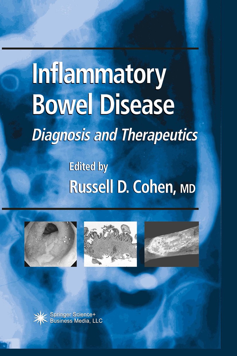 Titlebook: Inflammatory Bowel Disease; Diagnosis and Therap Russell D. Cohen Book 20031st edition Humana Press 2003 cancer.children.diagnosis.epidemio Titlebook: Inflammatory Bowel Disease; Diagnosis and Therap Russell D. Cohen Book 20031st edition Humana Press 2003 cancer.children.diagnosis.epidemio