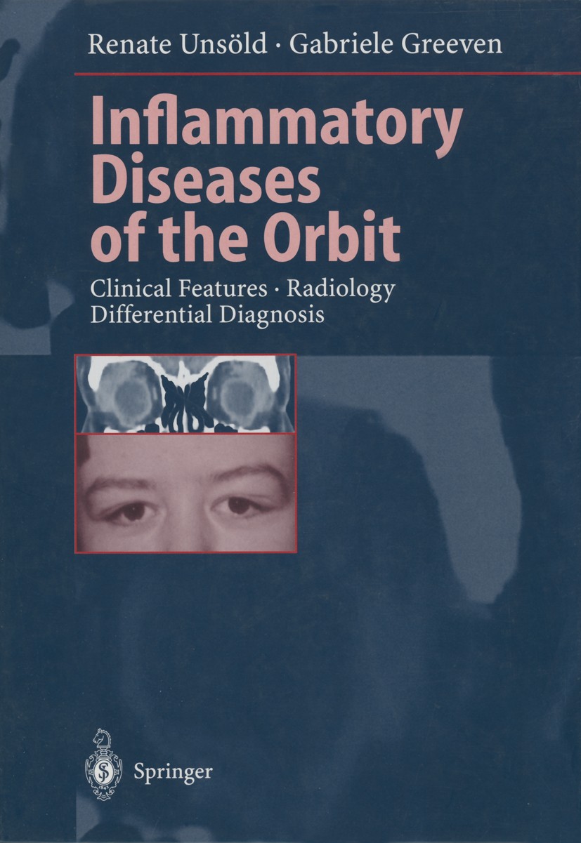 Titlebook: Inflammatory Diseases of the Orbit; Clinical Features · Renate Unsöld,Gabriele Greeven Book 2000 Springer-Verlag Berlin Heidelberg 2000 HN Titlebook: Inflammatory Diseases of the Orbit; Clinical Features · Renate Unsöld,Gabriele Greeven Book 2000 Springer-Verlag Berlin Heidelberg 2000 HN