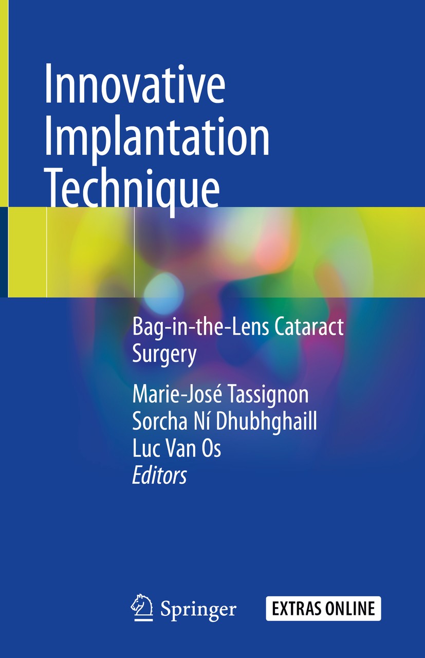 Titlebook: Innovative Implantation Technique; Bag-in-the-Lens Cata Marie-José Tassignon,Sorcha Ní Dhubhghaill,Luc Van Book 2019 Springer Nature Switze Titlebook: Innovative Implantation Technique; Bag-in-the-Lens Cata Marie-José Tassignon,Sorcha Ní Dhubhghaill,Luc Van Book 2019 Springer Nature Switze