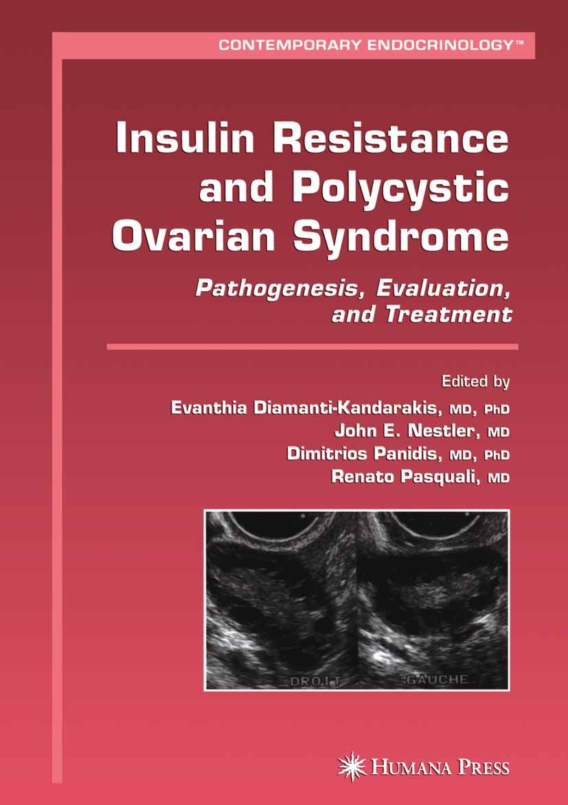 Titlebook: Insulin Resistance and Polycystic Ovarian Syndrome; Pathogenesis, Evalua Evanthia Diamanti-Kandarakis,John E. Nestler,Renat Book 2007 Human Titlebook: Insulin Resistance and Polycystic Ovarian Syndrome; Pathogenesis, Evalua Evanthia Diamanti-Kandarakis,John E. Nestler,Renat Book 2007 Human