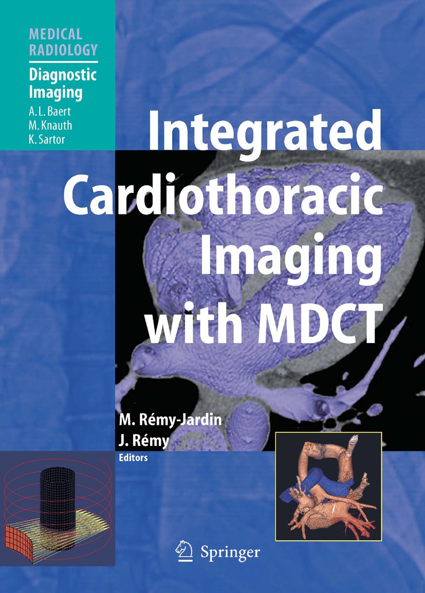Titlebook: Integrated Cardiothoracic Imaging with MDCT; Martine Rémy-Jardin (Professor),Jacques Rémy (Prof Book 2009 Springer-Verlag Berlin Heidelber Titlebook: Integrated Cardiothoracic Imaging with MDCT; Martine Rémy-Jardin (Professor),Jacques Rémy (Prof Book 2009 Springer-Verlag Berlin Heidelber